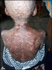 Nutritional support through an agricultural and aviculture project to assist undernourished children and adults.